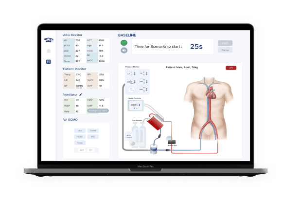 ECMO Training Program